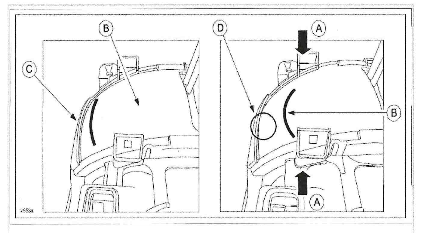 At left is a normal condition. At right is a deformed condition.