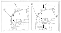 At left is a normal condition. At right is a deformed condition. At left is a normal condition. At right is a deformed condition.