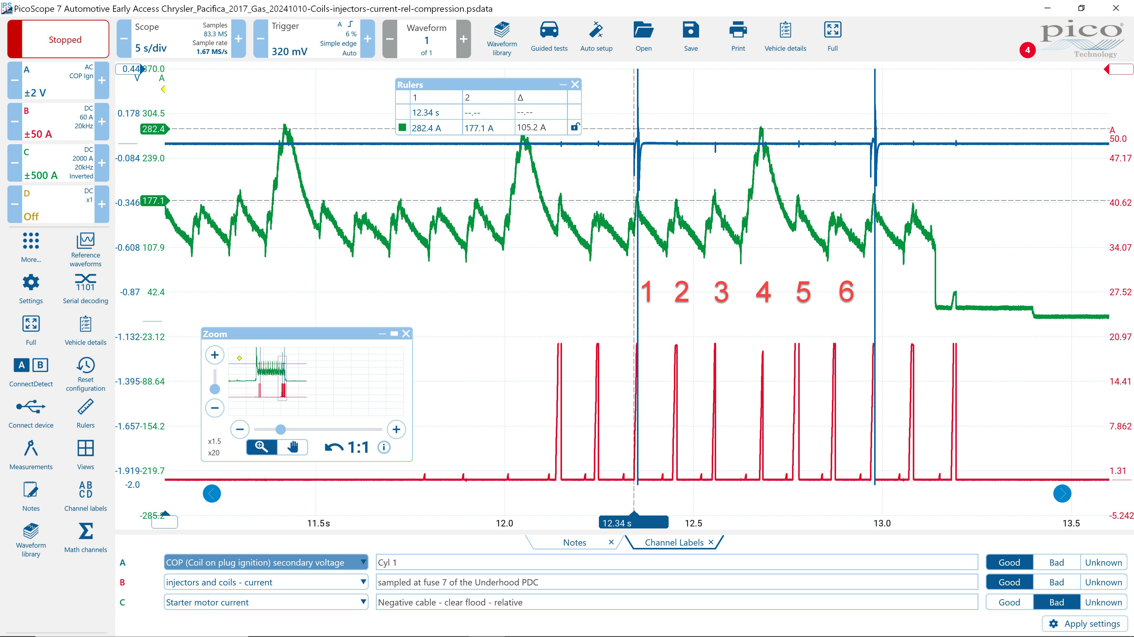 Figure 2 - Relative compression test using a PicosSope