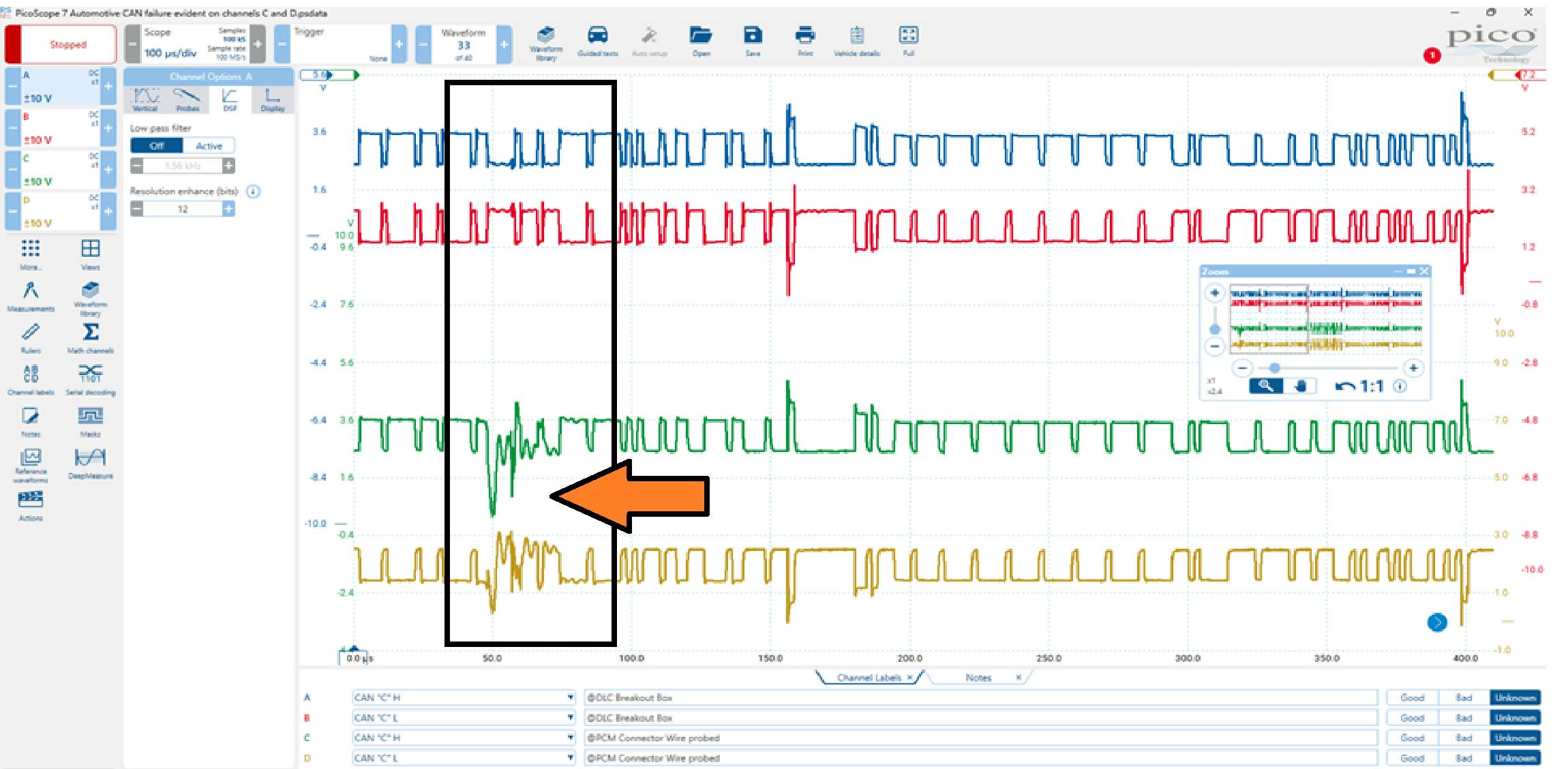 Figure 3: Waveforms of both CAN_HI and CAN_LO were captured at the DLC and at the PCM. This strategy captured the waveforms on either side of the Body Star Connector. The difference between the pairs (RED/BLUE vs. GREEN/YELLOW) can be seen and confirms a circuit issue is present in the media carrying the messages.